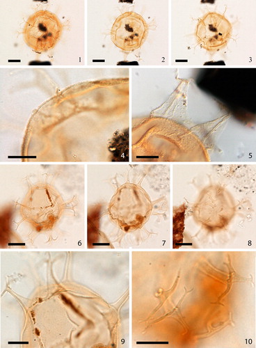 Plate 3. 1–3. Holotype of Spiniferites asperulus Matsuoka Citation1983 in ventral view at high to low focus. 4. Same specimen, mid-focus showing wall structure. 5. Same specimen, mid-focus showing antapical processes. 6–8. Holotype of Spiniferites firmus Matsuoka Citation1983 in ventral view at high to low focus. 9. Same specimen, showing microgranular wall. 10. Same specimen, showing distal ends of cingular processes. Slides provided by KM, photographed by KNM. All scale bars = 10 µm, except 1–3, 7–9 = 20 µm.