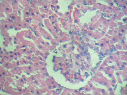 Figure 4. Mesangial cell proliferation and mild intertubular hemorrhage (H&E staining, ×280).