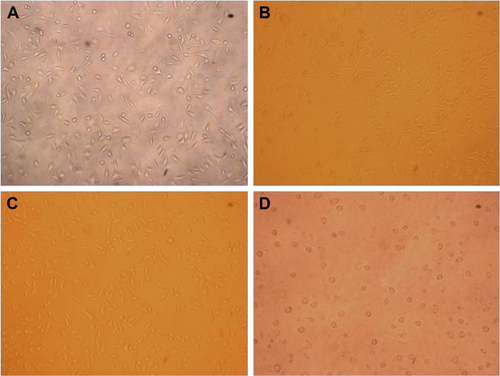 Figure S2 Optical micrographs of L929 cells cultured for 48 h (×100), (A) negative control, (B) 1.0 mg/mL, (C) 2.0 mg/mL of the leach liquors of SF/PLLA composite scaffolds and (D) positive control.Abbreviations: SF, silk fibroin; PLLA, poly(l-lactic acid).