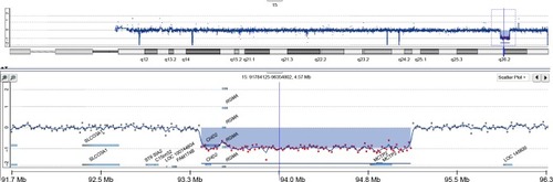 Figure 1 Copy number profile of chromosome 15 of the patient obtained by oligoarray-based comparative genomic hybridization (180K platform).