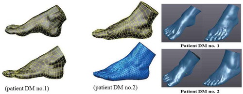 Figure 3. Output file of the RE foot patient in STL file format.