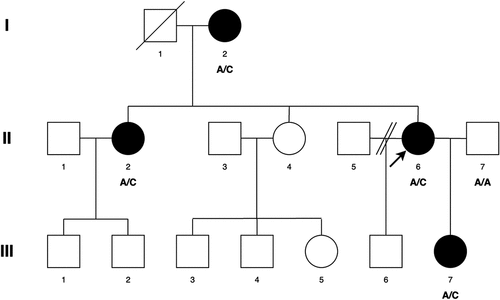 Figure 1. Abridged pedigree presenting with congenital cataract. Squares and circles symbolise males and females respectively. Diagonal lines through these symbols indicate deceased members of the pedigree. Open and filled symbols indicate unaffected and affected individuals respectively. Arrow indicates the proband (II-6). Affected individuals with the variant change at c.3621delA are labelled A/C (I-2, II-2, II-6, III-7). A/A is normal (II-7).