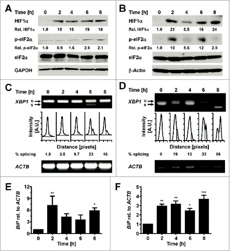 Figure 2. Hypoxia induces ER stress in adipocytes. Mihai and Schröder, p. 198.