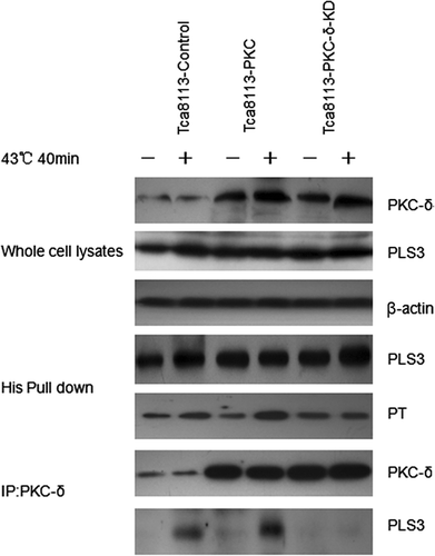 Figure 9. Heat enhances phosphorylation of PLS3 by PKC-δ. The Tca8113 cells were co-transfected with wild-type PLS3 plasmid and the control, wild-type PKC-δ or PKC-δ-KD plasmid for 24 h, respectively. The co-transfected cells were heated at 43°C for 40 min and then cultured at 37°C for 4 h, whole cell lysates were incubated with Ni beads to pull down His-tagged PLS3, and analysed with the antibodies against phosphothreonine and PLS3. PKC-δ was immunoprecipitated from whole cell lysates and analysed with antibodies against PKC-δ and PLS3. The interaction of PLS3/PKC-δ was enhanced by elevated PKC-δ expression, but no PLS3/PKC-δ interaction was observed with the PKC-δ-KD.