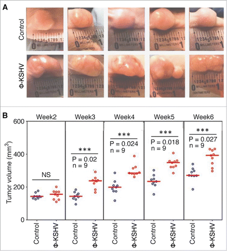 Figure 7. KSHV-induced TAMs enhance tumor growth in nude mice. A, representative images of tumors resulting from subcutaneous inoculation of equal numbers of (1 × 107/injection site) of TIVE-KSHV cells mixed with medium (control) or KSHV-induced TAMs (φ-KSHV) with a TIVE-KSHV to φ-KSHV ratio of 50 to 1 into nude mice at 6 weeks post-inoculation. B, average tumor volumes of the 2 groups of tumors described in (A) at different weeks post-inoculation. Statistically significant differences (P value < 0.05) are marked with 3 stars. NS, not significant; n, number of tumors per group.