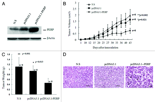 Figure 2. PERP overexpression inhibit lung cancer development in BALB/c nude mice. (A) PERP expression was detected in xenografts from N.S, Vector and PERP group, respectively. (B and C) Tumor growth curve (B) and weight (C) for Anip973 xenografts in mice undergoing PERP intervention. *p < 0.05, **p < 0.01. (D) H&E stainning of xenograft sections from N.S, Vector and PERP group, respectively. Arrows denote adenoid structure. Scale bar represents 100 μm.