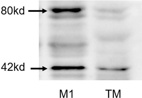 Figure 4 CD86 expression of T. marneffei protein was detected by Western blot. There was no positive band of 80kd compared with the protein from M1 macrophage.