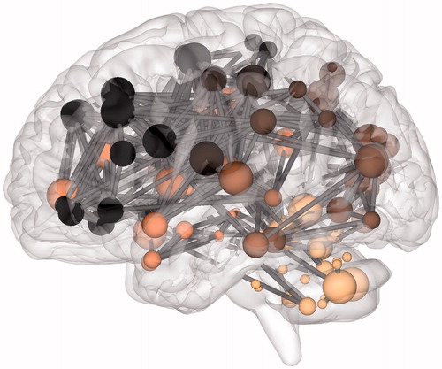 Figure 3. The connectome in glioblastoma. A sagittal view of an individual patient’s connectome at wavelet scale 2. Nodes are coloured according to their anatomical module (e.g. frontal, central, parietal, etc.) and their size is proportional to their degree. Connections (or edges) are presented in grey and represent the binary entries of the adjacency matrix. Locations are based on the co-ordinates of their original parcels and projected onto a surface reconstruction in MNI space.