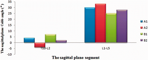 Figure 4. The sagittal plane Cobb angle of scoliosis after applying the four different solutions. After compression, the normal curvature in the sagittal plane (T10-L2, T12-L5) could be maintained.