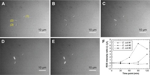Figure 8 Fluorescence images of Escherichia coli growth in the presence of Ag-doped CeONP with MIC50 dose.Notes: Growth with 0.25 mg/mL Ag-doped CeONP, the incubation time increases every 30 minutes; (A) 0, (B) 30, (C) 60, (D) 90, and (E) 120 minutes. (F) Time-dependence of the ROS fluorescence signal within the individual living E. coli cell. The ROS fluorescence signifies the intracellular ROS formation.Abbreviations: CeONP, cerium oxide nanoparticles; MIC50, minimal inhibitory concentrations required to inhibit the growth of 50% of bacteria; ROS, reactive oxygen species.