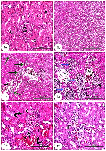 Figure 1. Photomicrographs of kidney section of control group showing (a,b): normal architecture of glomerulus (G) proximal tubule (P), distal tubule (D), and collecting tubule (CT) and tubular cells of renal medulla (Scale bar of a = 50 µm, Scale bar of b = 200 µm). Kidney section of CCl4-injected group showing (c,d): completely demolished glomeruli (G), dilated collecting tubules, collapsed glomeruli (blue arrow), congested glomeruli (green arrow), and congested blood vessels (arrow) (Scale bar of c = 200 µm and Scale bar of d = 100 µm). Kidney section of CCl4 group showing (e,f) monocellular leukocyte inflammation (IF), pyknotic nuclei (arrow), karyomegaly (curved arrow), intertubular fibrosis, and interstitial hemorrhages (H) (Scale bar of e and f = 50 µm).