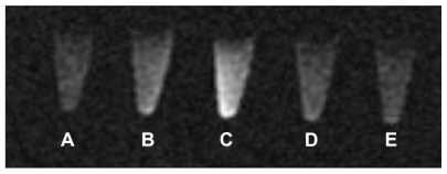 Figure 5 T1-weighted image of HeLa cells after incubated with contrast agents (coronal scan). (A) L. (B) L-Gd/calcein. (C) F-L-Gd/calcein. (D) F-L-Gd/calcein + 1 mM FA. (E) Gd-DTPA.Abbreviations: FA, folic acid; DTPA, diethylenetriamine pentaacetic acid.