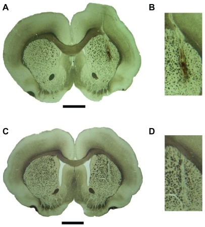 Figure 18 Coronal brain sections (50 μm) showing the site of intrastriatal implants. A) Freshly cut section of paraformaldehyde-fixed rat brain showing the trajectory of the dopamine-impregnated silica implant. Scale bar 2 mm. B) Higher magnification of the same silica–dopamine implant. Note the reddish-brown color characteristic of oxidized dopamine. C) Brain section from a rat implanted with the empty silica reservoir. Scale bar 2 mm. D) Higher magnification of the empty silica implant. Note the translucent color of the nanosilicon gel.