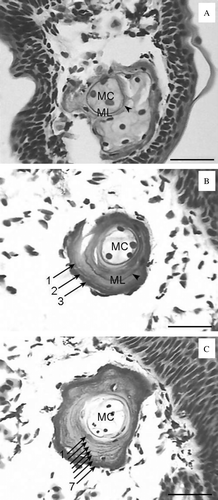 Figure 1.  Phalangeal cross-sections of Hynobius yangi and Hynobius quelpaertensis. An arrowhead indicates a metamorphosis line, and arrows indicate the lines of arrested growth (LAGs). MC=marrow cavity, ML=metamorphosis line. (A) A juvenile (SVL=23.8 mm) of H. quelpaertensis caught in February 2008. Only a metamorphosis line was observed. (B) A female of H. yangi (SVL=59.2 mm) caught in March 2006. A metamorphosis line and three LAGs were observed. This individual was three years old. (C) A male of H. quelpaertensis (SVL=63.3 mm) caught in March 2008. Seven LAGs were observed. This individual was seven years old. The scale bars represent 50 µm.