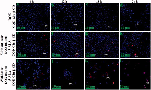 Figure 10. Fluorescent microscopic images of breast cancer (MCF-7) cell line incubated with DOX-loaded CQD-Glu-β-CD, and DOX-loaded 5-ALA-CQD-Glu-β-CD nanocarrier without and with laser irradiation in a various time-dependent manner such as 6 h, 12 h, 18 h, and 24 h and IC50 concentration of 60 μg/mL respectively at scale bar: ∼30 μm.