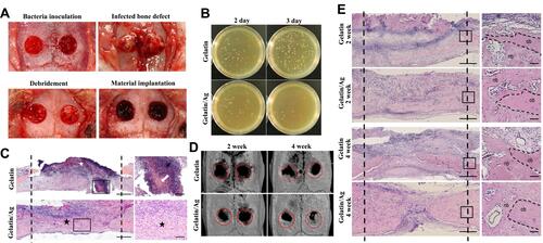 Figure 10 Gelatin sponge with colloidal silver (gelatin/Ag) promoted bone healing in infected cranial defects. (A) Creation of infected cranium defects and macroscopic appearance of the defects at main time points. (B) Antibacterial effect of Gelatin/Ag after debridement. (C) Representative images of HE-stained sections at 2 days after debridement. (D) Three-dimensional reconstructions of the cranium at 2 and 4 weeks. (E) Representative images of HE-stained sections of defects at 2 and 4 weeks. Reproduced with permission from Dong Y, Liu W, Lei Y, et al. Effect of gelatin sponge with colloidal silver on bone healing in infected cranial defects. Mater Sci Eng C Mater Biol Appl. 2017;70(Pt 1):371–377. Copyright©2016 Published by Elsevier B.V.Citation153