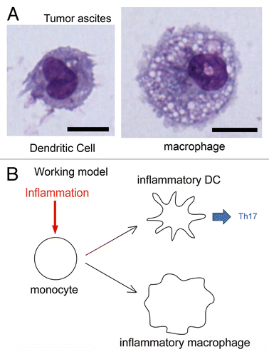 Figure 1. Identification of human inflammatory dendritic cells. (A) Human tumor ascites contain two populations of antigen-presenting cells: dendritic cells (DCs) and macrophages. Giemsa/May–Grünwald staining. Bar = 10 μm. (B) Like their murine counterparts, human inflammatory DCs differentiate from monocytes that are recruited by inflammatory microenvironments. These DCs induce TH17 responses, whereas inflammatory macrophages do not.