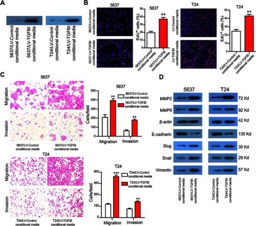 Figure 4 TGFBI in the supernatant promotes the malignant phenotypes of BCa cells. (A) TGFBI was efficiently secreted to cell culture medium. (B–D) The conditional medium derived from 5637/LV-TGFBI and T24/LV-TGFBI cells was treated to 5637 and T24 cells, respectively. The effects of TGFBI in the supernatant on cell proliferation (B) migration and invasion (C), and EMT markers (D) were detected. **P<0.01 and ***P<0.001 were considered statistically significant.