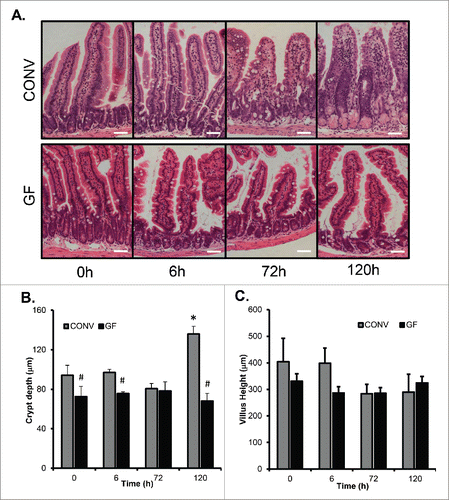 Figure 2. DOXO treatment does not alter crypt depth or villus height in GF mice. A. Micrographs of representative H&E stained sections from GF and CONV mice of control tissue and 6, 72 and 120 h following DOXO treatment. B. Quantitation of crypt depth on 10 15 crypts/villi in CONV and GF jejunal tissue from control mice and 6, 72, and 120 h after DOXO treatment. * indicates values significantly different from their respective controls p ≤ 0 .05. # indicates values significantly different within a particular time point p ≤ 0 .05. C. Quantitation of villus height in CONV and GF jejunal tissue from control mice and 6, 72, and 120 h after DOXO treatment. Scale bar: 50 μm.