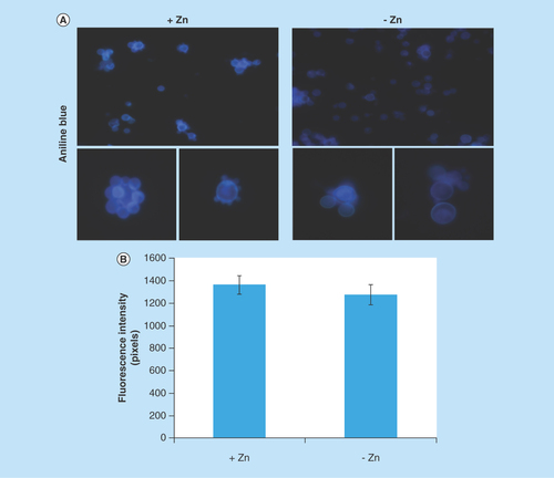 Figure 5.  Evaluation of β-1,3 glucan quantities in the cell wall of Paracoccidioides lutzii.(A) Aniline blue was used to evaluate, by fluorescence microscopy, the presence of β-1,3 glucan in the cell wall of P. lutzii after growth in the presence and absence of zinc (increase of 40 times). (B) Fluorescence intensity graph. The values of fluorescence intensity (in pixels) and the standard error of each analysis were used to plot the graph. Data are expressed as mean ± standard error (represented using error bars).
