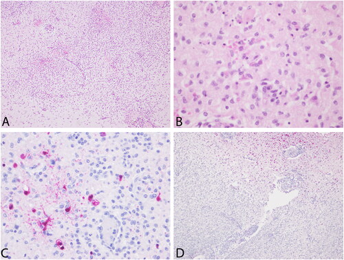 Figure 4. A. Brain. Male South American (SA) sea lion (245513). severe multifocal to locally extensive areas of non-suppurative encephalitis and hemorrhages. H&E, 10×. B. Brain. Male South American (SA) sea lion (245513). neuronal and glial necrosis with associated neuronophagia and gliosis. H&E, 40×. C. Brain. Male SA sea lion (245513). Intralesional positive immunostaining. IHC against Influenza A nucleoprotein in neurons and glial cells, IHC against Influenza A nucleoprotein, 40×. D. Arbor vitae of the cerebellum. Female sea lion (245719). Intralesional positive immunostaining. IHC against Influenza A nucleoprotein, 10×.