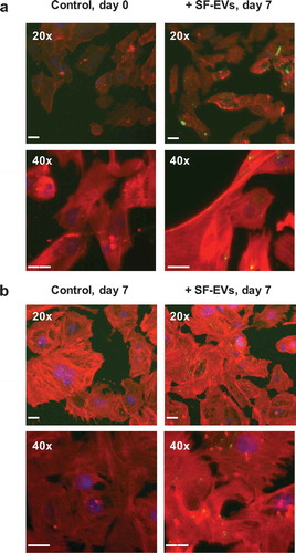 Figure 4. Binding of SF-EVs to primary ESCs: Fluorescence microscopy (a) Non-decidualised and (b) day 7 decidualised ESCs were incubated with bio-maleimide-labelled SF-EVs (5 × 1010 SF-EVs/106 cells) and fluorescence images were captured at 20× and 40× magnification; green = SF-EVs, red = β-actin, blue = nuclei. Scale bars represent 20 μm.