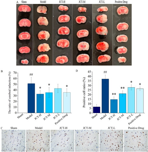 Figure 5. Therapeutic effect of JCT on cerebral ischaemic. (A) The representative images of TTC staining. (B) Quantitative analysis of TTC staining. (C) Images of TUNEL detection (magnification ×400). (D) Quantitative analysis of TUNEL staining (n= 5). ##p< 0.01 compared with the sham group; *p< 0.05 and **p< 0.01 compared with the model group.