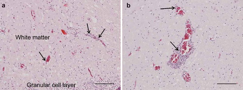 Figure 2. Photomicrographs of HE-stained sections, bar = 100 µm. Perivascular lymphoplasmacytic infiltrates and diffuse gliosis in the white matter of the cerebellum (A) and cerebrum (B).