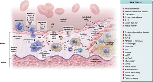 Figure 1. Cellular and Molecular Mechanisms of Atherosclerosis and the Role of EPA