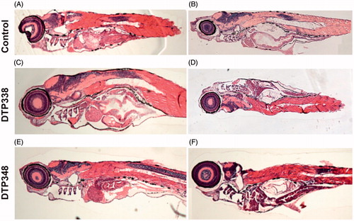 Figure 6. Histochemical images of control group and nitroimidazole inhibitors treated zebrafish larvae. (A) The image of larvae treated with 1% DMSO. (B) The image of zebrafish not treated with any drug. (C) The larvae treated with 2 mM concentration of DTP338. (D) The larvae treated with 500 μM concentration of DTP338. (E) The larvae treated with 2 mM concentration of DTP348. (F) The larvae treated with 500 μM concentration DTP348. The images presented here are selected from three independent groups of experiments. The sagittal sections show no apparent morphological changes or abnormalities in the tissues in the zebrafish larvae at the end of five days of exposure.