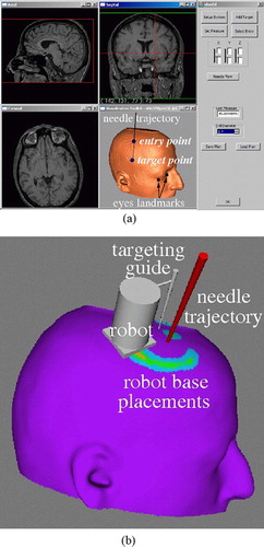 Figure 2. Preoperative planning module screens. (a) Entry and target point selection. (b) Robot base location and range. [colour version available online.]