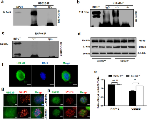 Figure 4. GGNBP2 interacts and colocalizes with UBE2B, and GGNBP2 loss affects UBE2B and RNF40 interaction.