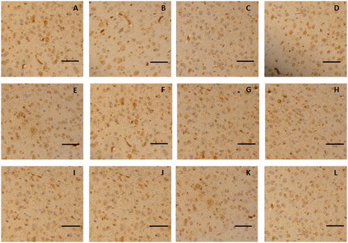 Figure 7. Representative immunohistochemical images of occludin in the brain tissue of glioma rat after borneol exposure at different time points: (A) 5 min in the control group, (B) 30 min in the control group, (C) 45 min in the control group, (D) 2 h in the control group, (E) 5 min in the low-borneol group, (F) 30 min in the low-borneol group, (G) 45 min in the low-borneol group, (H) 2 h in the low-borneol group, (I) 5 min in the high-borneol group, (J) 30 min in the high-borneol group, (K) 45 min in the high-borneol group and (L) 2 h in the high-borneol group. Scale bars, 100 μm.