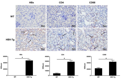 Figure 2. HBx upregulation and immune cells infiltration in HBV-Tg mice. Scale bar: 50 μm. Immunohistochemistry for HBx, CD4, and CD68 in the renal tissue from WT and HBV-Tg mice. Data are presented as the mean ± SD. *p < 0.05.