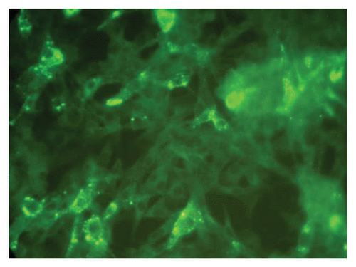 Figure 1. Showing the 50% end point dilution in the Rapid Fluorescent Focus Inhibition Test. Note approximately 50% BHK 21 cells in the microscopic field are infected as evidenced by presence of fluorescent foci representing rabies nucleoprotein (×400).