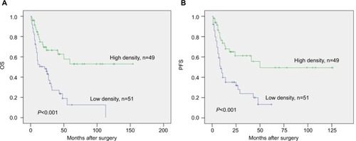 Figure 2 Kaplan–Meier analysis of OS (A) and PFS (B) according to CD8+ TILs in LSC.Abbreviations: LSC, lung sarcomatoid carcinoma; OS, overall survival; PFS, progression-free survival; TIL, tumor-infiltrating lymphocyte.