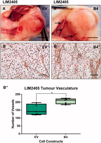 Figure 9. Evaluation of LIM2405 tumor vascularization. (A–A’) LIM2405 tumor vasculature at the time of harvesting (Scale bar =2mm). (B–B’) LIM2405 immunohistochemical labeling of vasculature with anti-Von Willibrand Factor in subcutaneous tumors (N = 5/cell construct/time point) (Scale bar =100µm) B’’, Quantification of vessel numbers using stereological point count method. *p < .05.