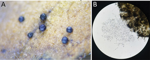 Figure 4. Microsclerotia produced by B. gigantea isolates. A. Dark, spheroid structures formed on leaf tissue. These structures ranged from 240 to 375 µm diam. B. Inner contents of a microsclerotium, apparently lacking ascospores.