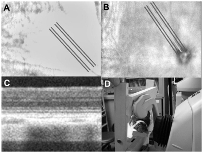 Figure 1 (A and B) Fundus photograph obtained using Cirrus™ HD-OCT before and after euthanasia, respectively. Optical coherence tomography (OCT) scanning includes the optic disk. (C) An OCT image obtained from a live rat. (D) The rat is placed on a custom-made platform, and the head and body are fixed.