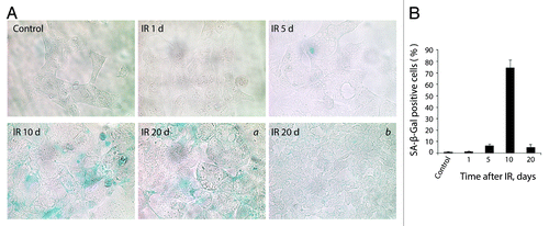 Figure 10. E1A + E1B cells overpass senescence induced by IR. (A) SA-β-Gal staining of untreated and irradiated cells was performed. Images were acquired in transmitted light, magnification 10 × 40. Giant cells remain SA-β-Gal-positive (a), whereas cells of near-normal size are SA-β-Gal-negative (b). (B) Quantification of the percentage of senescent cells stained for SA-β-Gal detection. Mean values with standard deviation are shown.