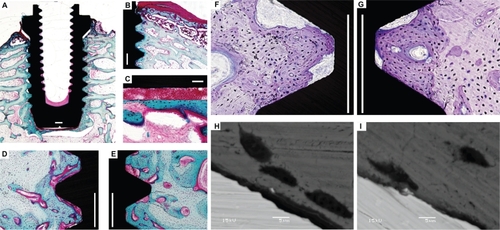 Figure 8 LM and BSE-SEM qualitative and quantitative observations of osseoconductivity on undecalcified cut and ground sections with the implants in bone. Basic fuchsin stained sections (A–E) show the following: well-developed trabecular architecture surrounding the implant placed in a rabbit femur A), pronounced new (immature woven) bone formation under the periosteum (dark pink staining) B), blood cells filling the space between the implant bottom and the new bone detached in the removal torque test C), newly formed bone (dark blue) inside the threads of the blasted implant D), and fluorinated TiO2 implants at the endosteal reagions E), clearly distinguished from the demarcation lines between dark and pale stained bone tissue. Toluidine-blue stained sections show variations in the nature of the direct bone contact between the blasted F) and fluorinated TiO2 implants G) (Scale bar = 500 μm). High-resolution BSE-SEM observations (3000×) show that the direct bone contact defined by LM observations turns out to be “real” direct bone/cell contact with the TiO2 nanotube implant surface more frequently than in the blasted implant (Scale bar = 5 μm).Abbreviations: LM, light microscopy; BSE-SEM, back scattered electron scanning electron microscopy.