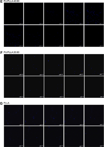 Figure S6 Confocal analysis showing presence of KG1a cells at different depths of the scaffold. Slices (10 μm) of the composite image shown in Figure S5 following confocal imaging with 4′,6-diamidino-2-phenylindole (DAPI) of KG1a cells adhered to the fibronectin-coated different scaffold composites (A–G), following 2 hours’ incubation.Abbreviations: PLLA, poly-l-lactic acid; PU, polyurethane.