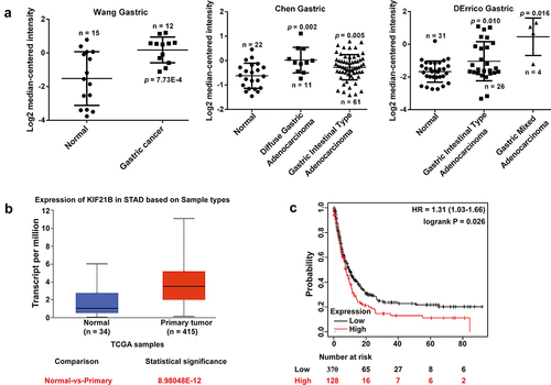 Figure 1. Expression of KIF21B mRNA in GC tissues; (a) The mRNA expression of KIF21B in Oncomine datasets including Wang Gastric, Chen Gastric and DErrico Gastric. (b) KIF21B expression level comparison between normal and tumor tissues obtained from the UALCAN web tool (Wilcoxon test). TCGA: The Cancer Genome Atlas; STAD: stomach adenocarcinoma. (c) Kaplan-Meier survival curves comparing the high and low expression of KIF21B in GC in Kaplan-Meier plotter database.