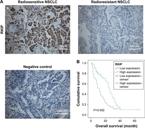 Figure 1 RKIP reduction is correlated with NSCLC radiation resistance and poor overall survival.