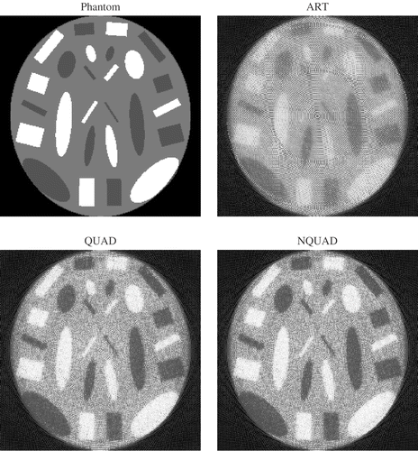 Figure 6. Case 2: phantom and reconstructed images (10 iterations) after histogram equalization.