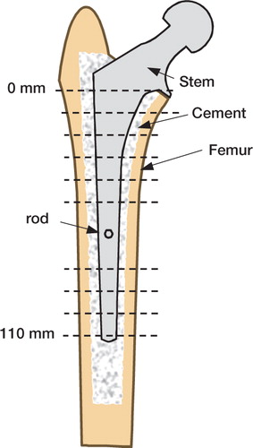 Figure 1. Schematic cross section of a stem/cement/femur construct.Dashed lines indicate transverse sectioning levels at 10-mm intervals.Two central sections, which were affected by the portal for the micromotion measurement rod, were not analyzed.