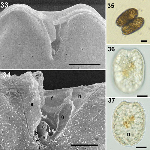 Figs 33–37. Prorocentrum sp. strain Dn32EHU. 33, 34. SEM. 33. Right valve showing the V-shaped indentation of the periflagellar area. 34. Detail of some platelets and flagellar pore (FP) of the periflagellar area and two sized thecal pores. 35–37. LM. 35. Cells dividing into a transparent division cyst. 36. Focus on the right valve showing the V-shaped indentation of the periflagellar area. 37. Cell showing the nucleus (n). Scale bars: 2 µm (Fig. 34); 5 µm (Fig. 33); 10 µm (Figs 35–37).