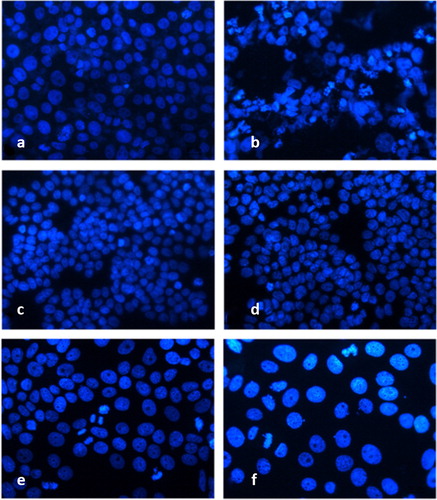 Figure 4. Fluorescence microscopy of human tumour cells after 24 h treatment with metamizole. HeLa control (a); HeLa metamizole 400 µg/mL (b); HT-29 control (c); HT-29 metamizole 300 µg/mL (d); MCF-7 control (e); MCF-7 metamizole 400 µg/mL (f). Magnification 40Х, DAPI staining.