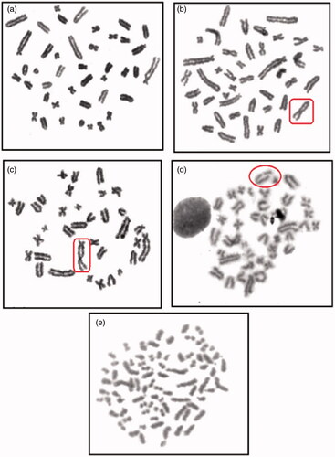 Figure 3. Chromosomal aberrations analysis of bone marrow cells in treated rats compared to controls showing: (a) normal chromosome; (b) chromatid exchanges (EXC); (c) dicentric chromosome (DIC); (d) a double strand break (DSB); (e) polyploidy metaphasis (PLP).