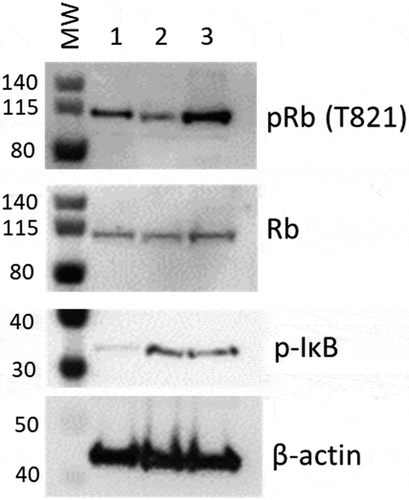 Figure 11. Western blot analysis for phospho- Rb or IkB in protein from mCherry negative versus mCherry positive cells. Cells infected with DHIV3-mCherry were purified by FACS sorting based on their expression of mCherry fluorescence. Lane 1, Protein from Control cells; Lane 2, Protein from PIC/Bystander cells; Lane 3, Protein from Provirus cells. Phospho-Rb (Phospho-T821 Rb antibody) was used to quantify Rb pocket phosphorylation, anti-Rb control antibody was used to quantify Rb protein levels relative to actin (visualized with beta-actin antibody). PIC/Bystander cells show the lowest level of Rb phosphorylation, Provirus show the highest, in close agreement with Transcription Factor Targeting results. Phospho-IkB S32 antibody was used to quantify activated IkB. Control cells show the lowest level of IkB phosphorylation, no difference was detectable between Provirus and PIC Cluster cells.